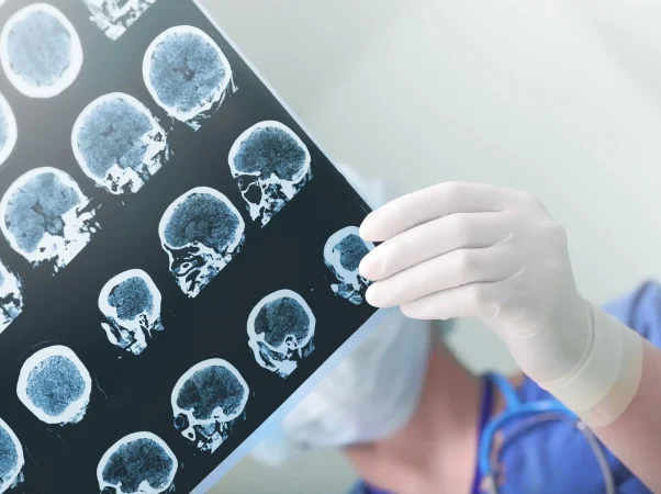 doctor-holding-xray.jpg
